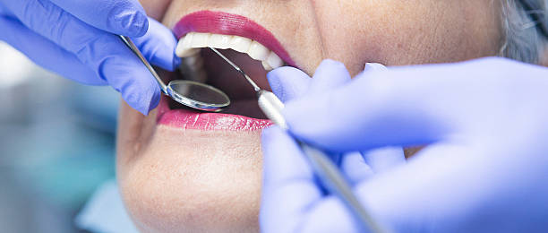 Best Emergency Orthodontic Repairs in Los Gatos, CA